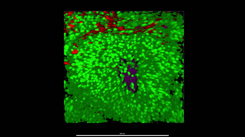 Lightsheet brain organoid VZ and Cortical plate