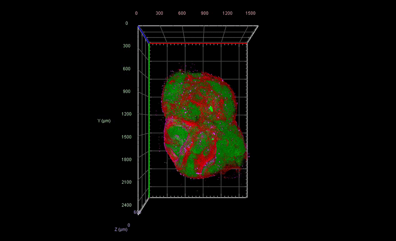 3D reconstruction of brain organoid from lightsheet